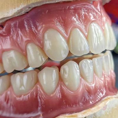 China Precieze tijdelijke volledige acrylprothese tanden Ivoclar ISO goedgekeurd Te koop