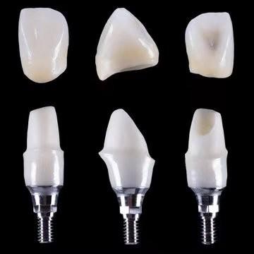 Chine Implant dentaire Tibase Zirconia Abutment Titane précision personnalisée à vendre