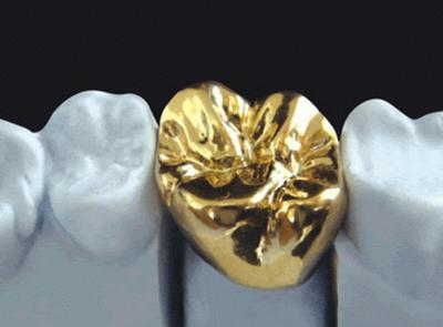 China High Nobel Yellow Gold Crown Professional Ni Be Free ISO Approved for sale