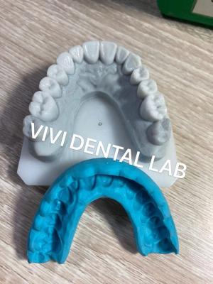 China Stable Dental Crown Diagnostic Wax Up For Orthodontic Treatment for sale