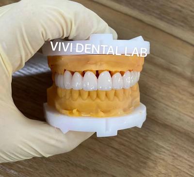China CE Dental Tooth Crowns Nickel Beryllium Free VIVI Dental Laboratory for sale