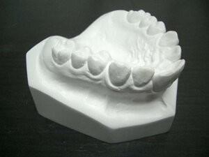 China Cirurgia Oral Correção de Alinhamento Dentário Pedra Branca Dentes Dentários Modelo de Estudo à venda