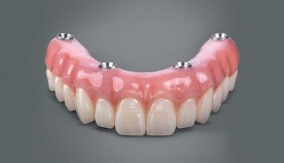 Китай Стоматологический все на 4 имплантаты поддерживаемые зубные протезы Профессиональный натуральный вид продается