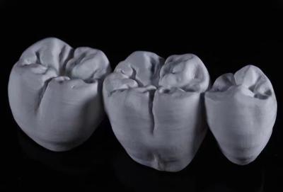 China VIVI Coroas de laboratório dentário multicamadas Coroa de zircônio monolítico à venda