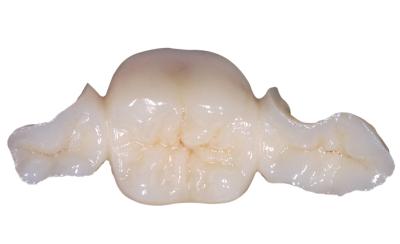 중국 치아 치아 지르코니아 메릴랜드 브리지 높은 미용 FDA 인증 판매용