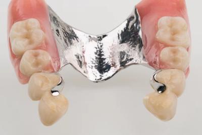 China Dental Precision Attachment Partial Denture Ivoclar Scheftner for sale