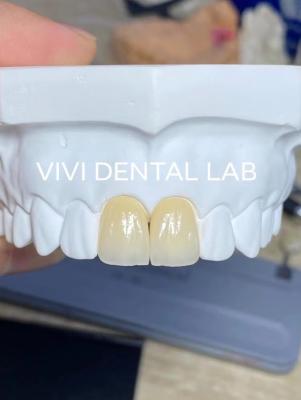 China Coroas de laboratório dentário de precisão Ivoclar Estética Coroas de zircônia de aparência natural à venda