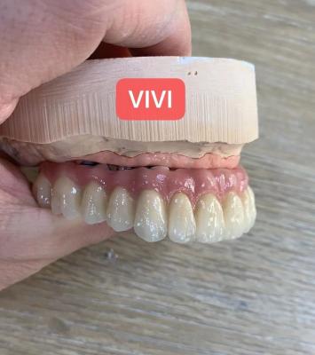 Chine Implantation dentaire esthétique ISO Implantation dentaire de pont précise à vendre