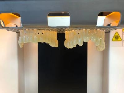 China Coroas de laboratório dentário de concha provisórias Dentes PMMA Coroa temporária à venda