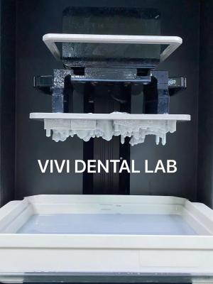 China Impresión digital en 3D Coronas dentales Dentes profesionales precisos en venta