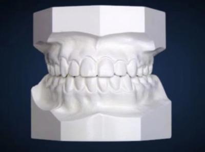China Modelo de estudio de ortodoncia dental Ekodent para el tratamiento de ortodoncia en venta
