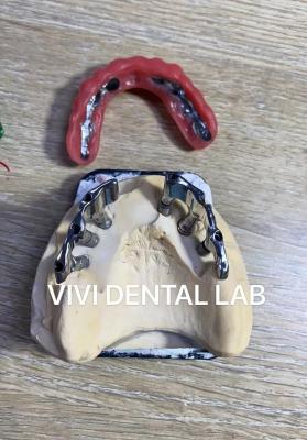 China Precise Bar Implant Supported Hybrid Denture Scheftner Ivoclar Material for sale