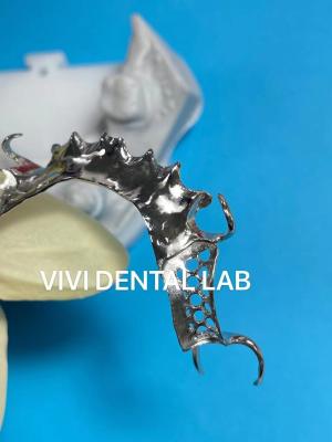 China Printed Scheftner Metal Partial Denture Framework Accurate Customized for sale