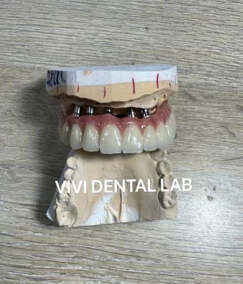 China Laboratorio dental de China del puente total del implante PFM en venta