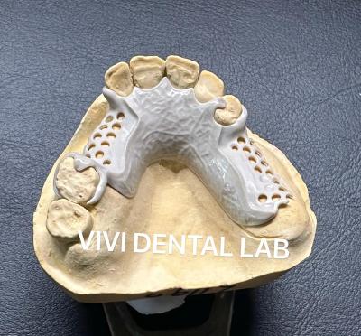 China Peek partial framework ISO CE and FDA China dental lab ISO CE and FDA for sale