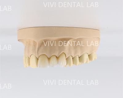 Chine Couronnes dentaires anatomiques naturelles de haute résistance de laboratoire de la Chine à vendre