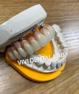 Chine Implantation dentaire en ciment couronne professionnelle en parfaite forme certifiée FDA à vendre