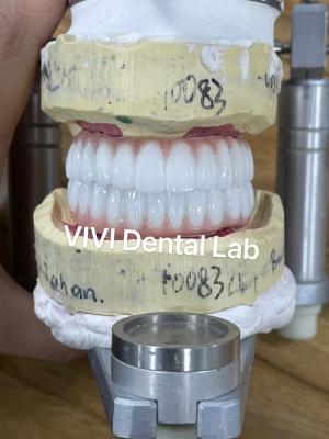 China Ni Be Free Zirconia Dental Implant Bridge On Bar High Esthetics for sale