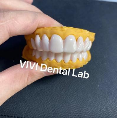 Cina Dental Snap On Smile Veneers Alta estetica Certificato ISO FDA in vendita