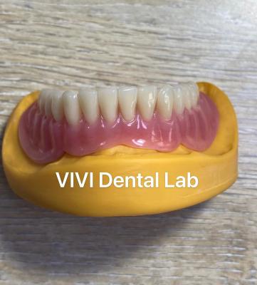 China Dentes de dentadura de acrílico completo de alta estética diseñados y fresados en venta