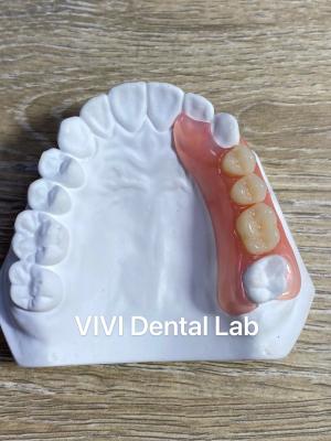 China Alta estética Flexible Dentadura parcial acrílica / Valplast Dentarias Parciales en venta