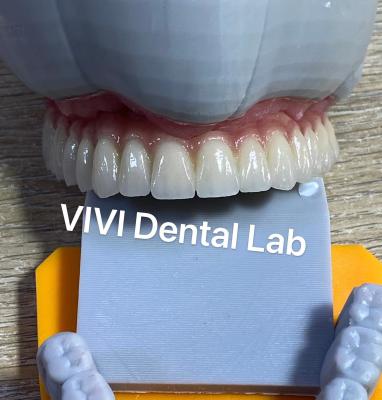China Translucidez Digital Coronas dentales Dientes Alta estética personalizada en venta
