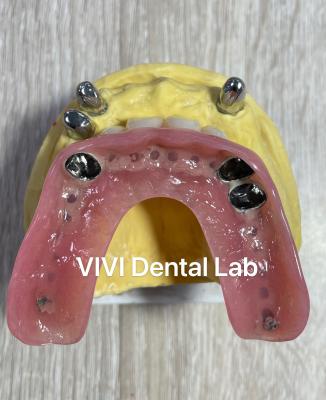 China CAD CAM Tooth Partial Denture Attachment Dental Professional Accurate for sale