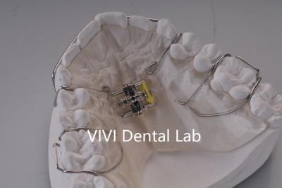 Κίνα Τεχνητή ορθοπλαστική οδοντοστοιχία προς πώληση