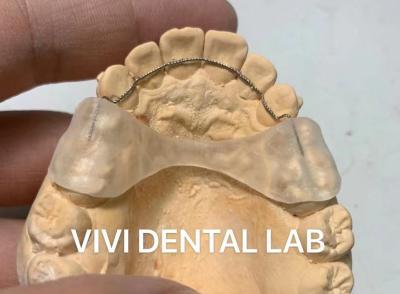 Chine Dents en fil de fer lié Retenant orthodontique Professionnel permanent à vendre