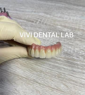 China Digital Dental Implant Crown And Bridge High Esthetics Customized for sale