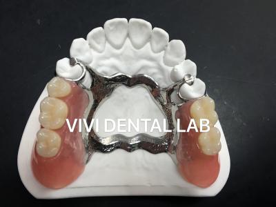China Cuadro de dentadura parcial de aleación de metal 3 Impresión con láser Exocad en venta