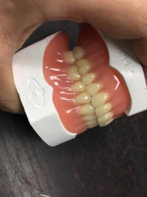 China Ivoclar curado por calor con dentadura completa acrílica Laboratorio dental de alta precisión en venta