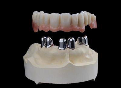 China Telescopic Dental Lab Crowns High Accuracy For Older People for sale