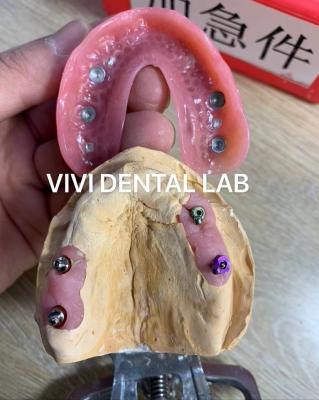 China Apego de precisión Dentadura parcial Apego de precisión dental profesional en venta