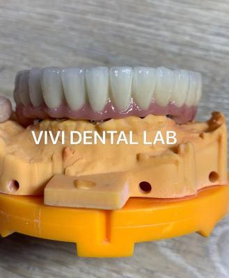 China Coroas Dentárias Digitais Estéticas Implante Dental Translúcido Coroa à venda