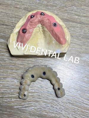 China Screwed All On Four Zirconia Bridge Ivoclar Dental High Accuracy for sale