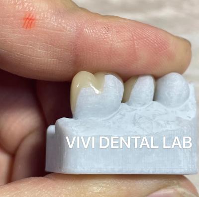 Китай Профессиональный Emax стоматологический инлей Onlay высокоточность цифровой обработки продается