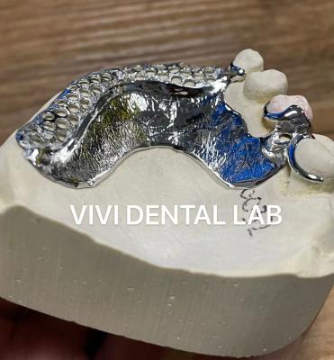 China Impresión con láser de cobalto cromo marco de dentadura parcial Ni ser libre en venta