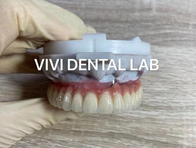 China Screw Implant Digital Dental Crowns And Bridge Scheftner Ivoclar Translucency for sale