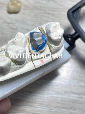 China Dental Metal Post And Core Crown co cr Accurate Retentive for sale