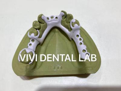 China CAD CAM PEEK Partial Denture Framework 3Shape Exocad Denture Design for sale