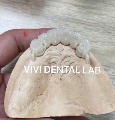 China Zirconia Dental Attachment Partial Denture Stable CAD CAM ISO Approved for sale
