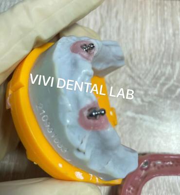 China Ivoclar Implant Ball Attachments Removable Dental Implant Material For Oral Hygiene for sale