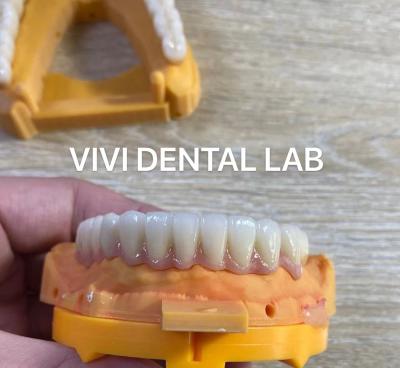 China Full Jaw Dental Zirconia Bridge Implant Crown Translucency Esthetic for sale