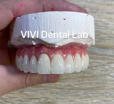 China Implant Metal Ceramic Dental Bridges Screwed Retained With Stump for sale
