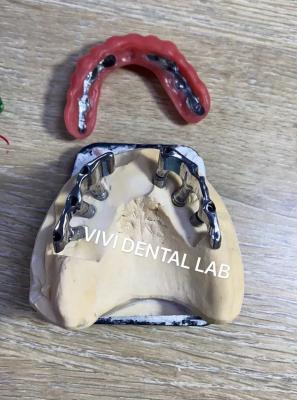 China Implantes dentales con barra de apoyo de dentaduras para edentulous en venta