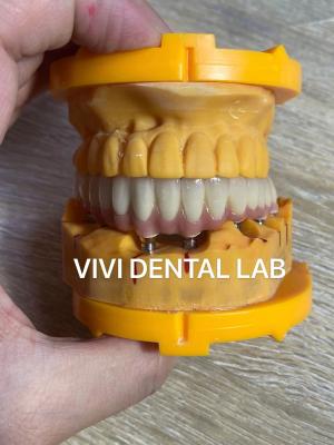 China Translucent Digital Dental Crowns Implant PFM With Pink Porcelain for sale