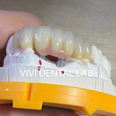 China Puente de implantes dentales de porcelana de zirconia alta estética profesional en venta