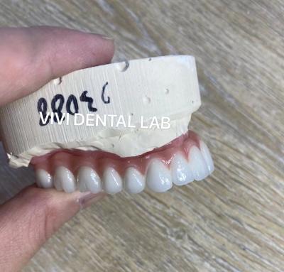 China Natural Looking Esthetic Screw Retained Zirconia Implant Crown Long Lasting for sale