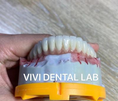 China Digital Cement Dental Bridge Implant Translucency FDA Certified for sale